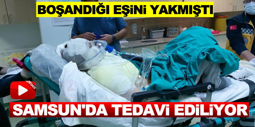 Eski eşi tarafından yanıcı maddeyle yaralanan kadın Samsun'da tedavi ediliyor