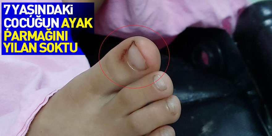 Ayak parmağını yılan sokan 7 yaşındaki çocuk hastanelik oldu