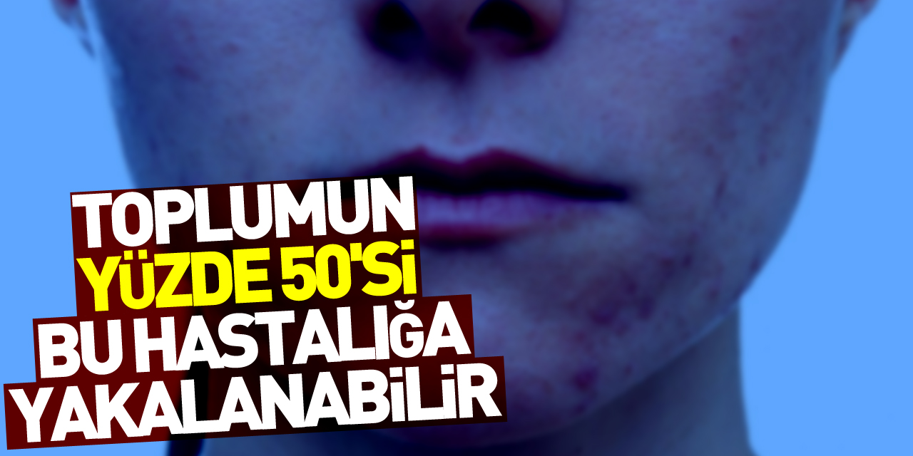 2030 yılında toplumun yüzde 50'si alerjik hasta olabilir