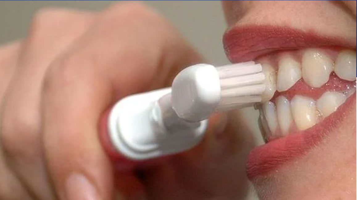 İnternetten alınan diş beyazlatma kitlerine dikkat