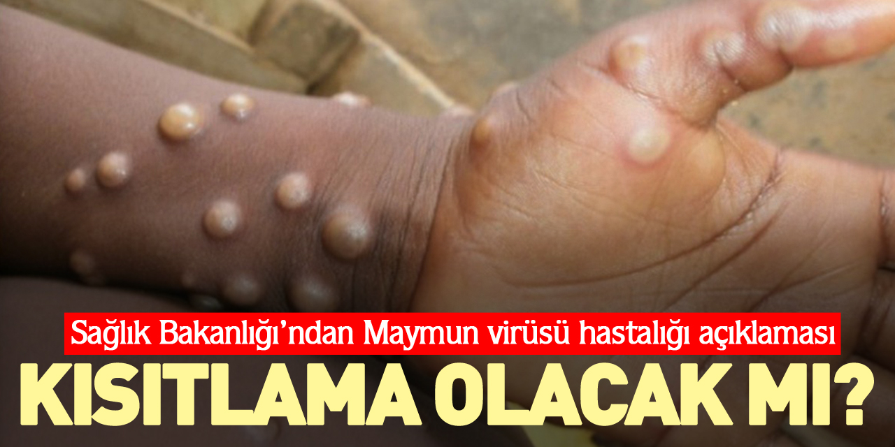 KISITLAMA OLACAK MI?