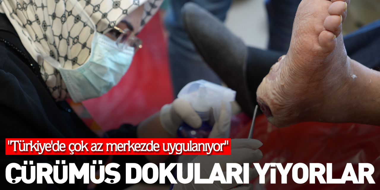 Çürümüş dokuları yiyorlar