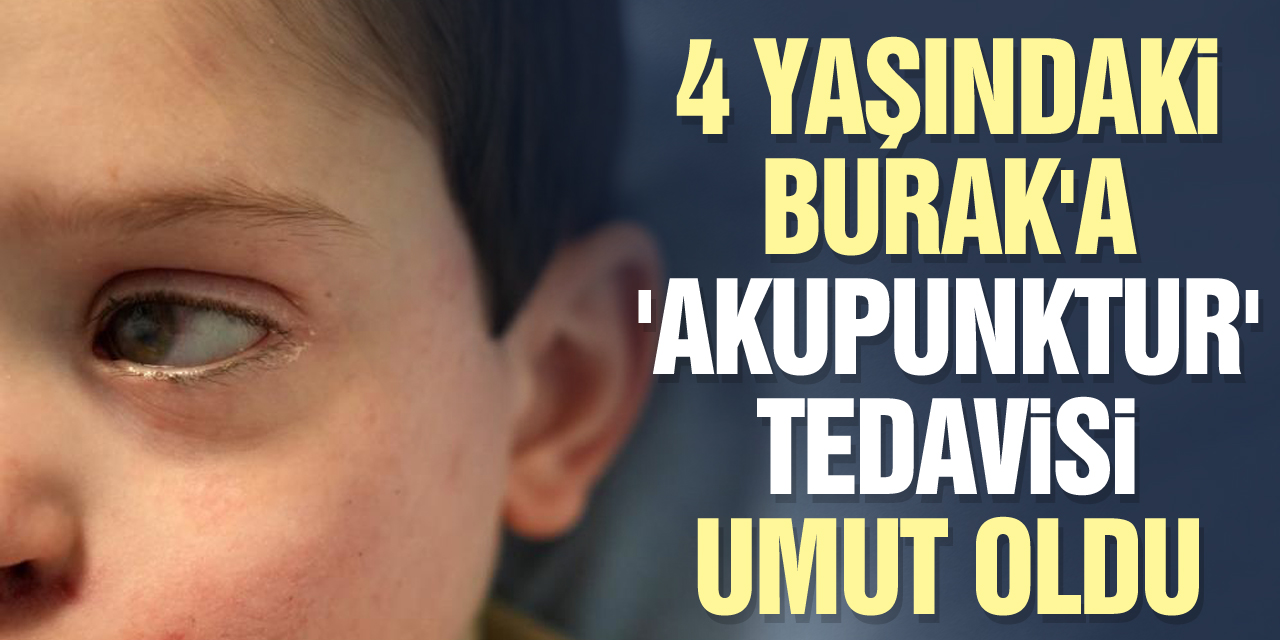 4 yaşındaki Burak'a 'akupunktur' tedavisi umut oldu