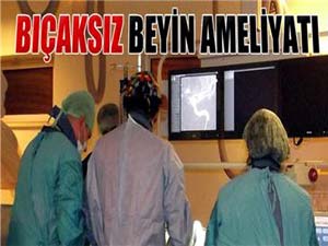 Bıçaksız beyin ameliyatı