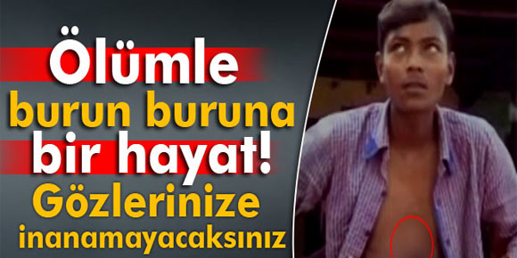 Ölümle burun buruna bir hayat! Kalbi dışarıda atıyor