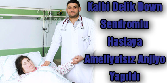 Kalbi Delik Down Sendromlu Hastaya Ameliyatsız Anjiyo Yapıldı