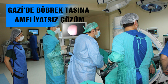 GAZİ’DE BÖBREK TAŞINA AMELİYATSIZ ÇÖZÜM