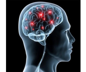 Beyin damar tedavisinde altın yöntem