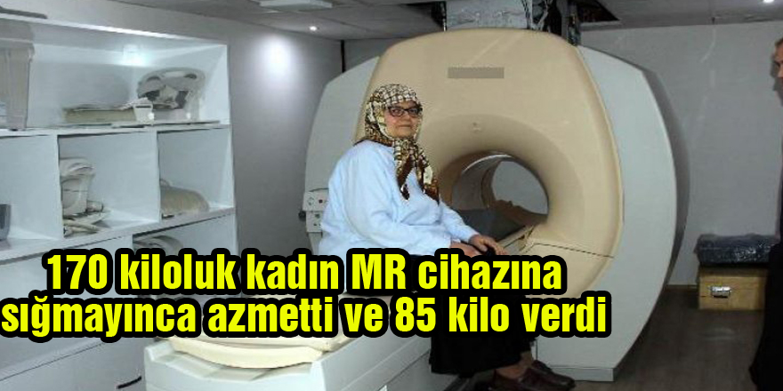 170 kiloluk kadın MR cihazına sığmayınca azmetti ve 85 kilo verdi