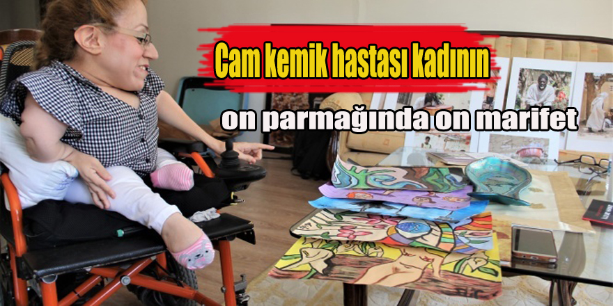 Cam kemik hastası kadının on parmağında on marifet