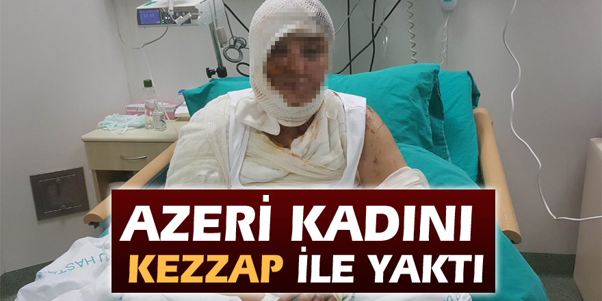 Azeri kadını kezzap ile yaktı