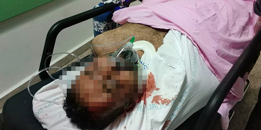  Samsun'da balkondan düşen Iraklı ağır yaralandı 