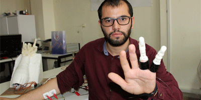 İki parmağını kaybeden mühendislik öğrencisi, kendine protez parmak yaptı