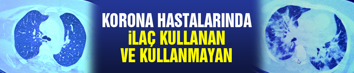 İlaç kullanan korona hastaları ile kullanmayanlar arasındaki inanılmaz fark