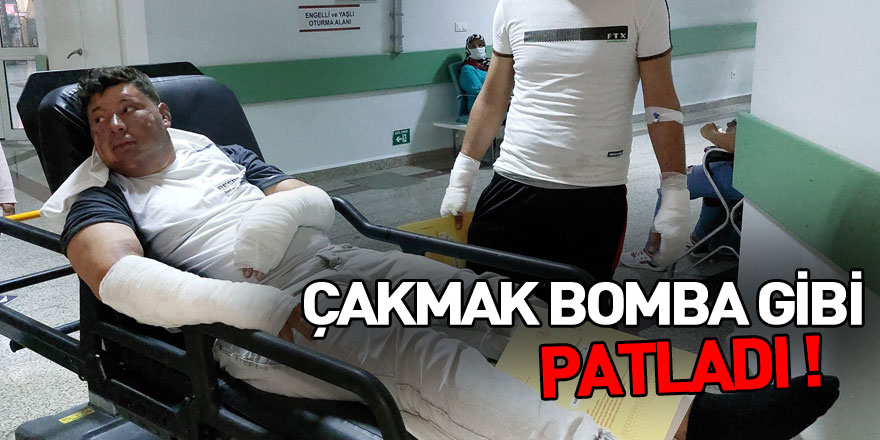 Çakmak bomba gibi patladı: 2 yaralı