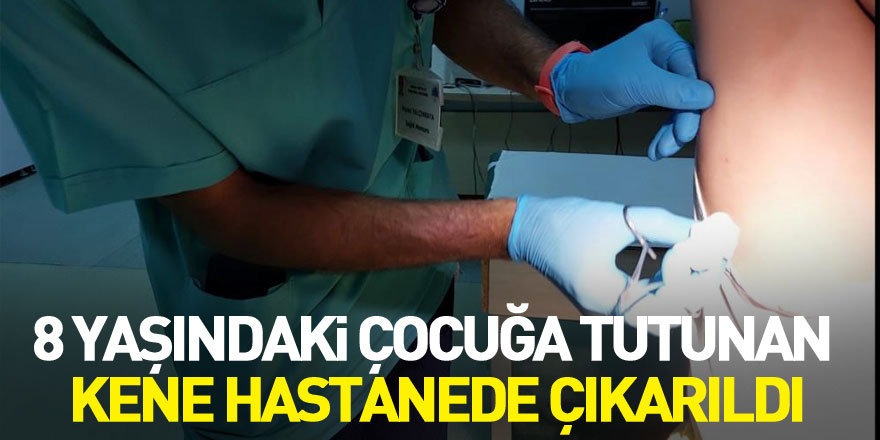 Samsun'da 8 yaşındaki çocuğa tutunan kene hastanede çıkarıldı